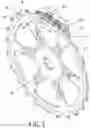 Fig. 03 - Sprocket and chain assembly for bicycle