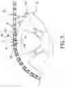 Fig. 06 - Sprocket and chain assembly for bicycle