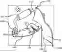 Fig. 01 - Pull-behind watercraft accessory device with stabilizer fin