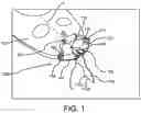 Fig. 02 - Pull-behind watercraft accessory device with stabilizer fin