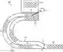 Fig. 01 - Buffer device and method for buffering containers