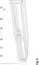 Fig. 10 - Rope guiding device of rope hoist