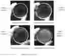 Fig. 07 - RADIATION SHIELDING GLASS ARTICLES