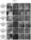 Fig. 04 - DIELECTRIC CERAMICS, METHOD FOR PREPARING THE SAME, AND MULTILAYERED ELECTRIONIC COMPONENT COMPRISING THE SAME