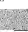 Fig. 06 - SILICON NITRIDE SINTERED BODY, METHOD FOR PRODUCING SAME, MULTILAYER BODY AND POWER MODULE