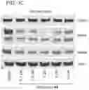 Fig. 04 - Small molecule degraders of Helios and methods of use