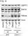 Fig. 16 - Small molecule degraders of Helios and methods of use