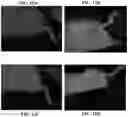 Fig. 20 - Imidazoquinoline compounds and prodrugs thereof