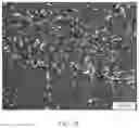 Fig. 14 - Crystal Forms of (S)-4-(8-amino-3-(1-(but-2-ynoyl)-pyrrolidin-2-yl)imidazo[1,5-a]pyrazin-1-yl)-n-(pyridin-2-yl)benzamide