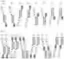 Fig. 34 - CHIMERIC PROTEINS AND CHIMERIC PROTEIN COMPLEXES DIRECTED TO FMS-LIKE TYROSINE KINASE 3 (FLT3)
