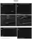 Fig. 07 - Antibodies specific for hyperphosphorylated tau and methods of use thereof