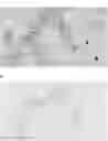 Fig. 01 - INTEGRIN ALPHA10 AND AGGRESSIVE CANCER FORMS