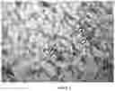 Fig. 04 - INTEGRIN ALPHA10 AND AGGRESSIVE CANCER FORMS