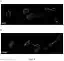 Fig. 05 - INTEGRIN ALPHA10 AND AGGRESSIVE CANCER FORMS