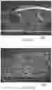 Fig. 06 - Compositions and foam compositions containing composite particles, articles, composite particles, and methods