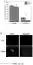 Fig. 18 - 'SMART' HYDROGEL FOR THE RADIOSENSITIZATION AND SUSTAINED DELIVERY OF THERAPEUTICS TRIGGERED BY IRRADIATION