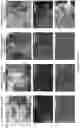 Fig. 22 - 'SMART' HYDROGEL FOR THE RADIOSENSITIZATION AND SUSTAINED DELIVERY OF THERAPEUTICS TRIGGERED BY IRRADIATION