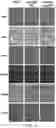 Fig. 32 - 'SMART' HYDROGEL FOR THE RADIOSENSITIZATION AND SUSTAINED DELIVERY OF THERAPEUTICS TRIGGERED BY IRRADIATION