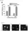Fig. 15 - MICROFLUIDIC SYSTEM FOR INTRACELLULAR DELIVERY OF MATERIALS AND METHOD THEREFOR