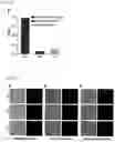 Fig. 17 - MICROFLUIDIC SYSTEM FOR INTRACELLULAR DELIVERY OF MATERIALS AND METHOD THEREFOR
