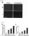 Fig. 20 - MICROFLUIDIC SYSTEM FOR INTRACELLULAR DELIVERY OF MATERIALS AND METHOD THEREFOR