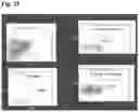 Fig. 36 - METHODS OF GENERATING AND ISOLATING MIDBRAIN DOPAMINE NEURONS