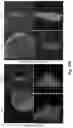 Fig. 49 - METHODS OF GENERATING AND ISOLATING MIDBRAIN DOPAMINE NEURONS