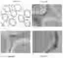 Fig. 17 - Cytopheresis cartridges and use thereof
