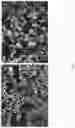 Fig. 22 - Cytopheresis cartridges and use thereof