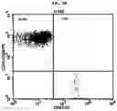 Fig. 04 - ADDITIVE COMPOSITION FOR NK CELL CULTURE MEDIUM, CULTURE METHOD FOR NK CELL BY USING SAME ADDITIVE COMPOSITION, AND COSMETICS COMPOSITION OBTAINED THEREBY FOR IMPROVING SKIN PROBLEMS