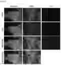Fig. 08 - METHOD FOR INDUCING DIRECT REPROGRAMMING OF URINE CELL INTO RENAL PROGENITOR CELL AND PHARMACEUTICAL COMPOSITION CONTAINING REPROGRAMMED RENAL PROGENITOR CELL