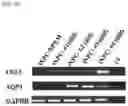 Fig. 21 - METHOD FOR INDUCING DIRECT REPROGRAMMING OF URINE CELL INTO RENAL PROGENITOR CELL AND PHARMACEUTICAL COMPOSITION CONTAINING REPROGRAMMED RENAL PROGENITOR CELL