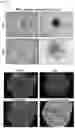 Fig. 23 - METHOD FOR INDUCING DIRECT REPROGRAMMING OF URINE CELL INTO RENAL PROGENITOR CELL AND PHARMACEUTICAL COMPOSITION CONTAINING REPROGRAMMED RENAL PROGENITOR CELL