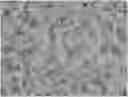 Fig. 01 - METHOD FOR CULTURING PRIMARY CELLS OF GASTRIC CANCER AND GALLBLADDER AND BILE DUCT CANCER, AND SUPPORTING REAGENTS