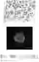 Fig. 03 - METHOD FOR CULTURING PRIMARY CELLS OF GASTRIC CANCER AND GALLBLADDER AND BILE DUCT CANCER, AND SUPPORTING REAGENTS