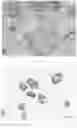 Fig. 05 - METHOD FOR CULTURING PRIMARY CELLS OF GASTRIC CANCER AND GALLBLADDER AND BILE DUCT CANCER, AND SUPPORTING REAGENTS