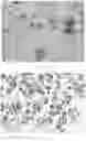 Fig. 07 - METHOD FOR CULTURING PRIMARY CELLS OF GASTRIC CANCER AND GALLBLADDER AND BILE DUCT CANCER, AND SUPPORTING REAGENTS