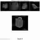 Fig. 09 - METHODS FOR CONTROLLED INDUCTION OF BIOENGINEERED NEUROEPITHELIAL TISSUES AND 3-D NEUROEPITHELIAL TUBES