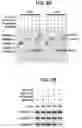 Fig. 12 - NOVEL BOTULINUM NEUROTOXIN AND ITS DERIVATIVES