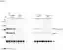 Fig. 37 - Antisense Oligonucleotides Targeting ATXN3