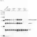 Fig. 38 - Antisense Oligonucleotides Targeting ATXN3