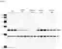 Fig. 41 - Antisense Oligonucleotides Targeting ATXN3