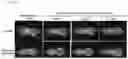 Fig. 20 - RNA-nanostructured double robots and methods of use thereof