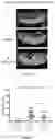 Fig. 05 - Compositions and Methods for Allelic Gene Drive Systems and Lethal Mosaicism