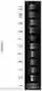 Fig. 03 - Recombinant nucleic acid molecule of transcriptional circular RNA and its application in protein expression