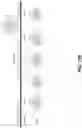 Fig. 103 - SYNTHETIC CIRCUIT FOR CELLULAR MULTISTABILITY