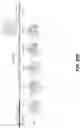 Fig. 120 - SYNTHETIC CIRCUIT FOR CELLULAR MULTISTABILITY