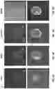 Fig. 07 - THERAPEUTIC PARTICLES THAT ENABLE ANTIGEN PRESENTING CELLS TO ATTACK CANCER CELLS