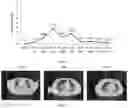 Fig. 07 - CYBB LENTIVIRAL VECTOR, LENTIVIRAL VECTOR-TRANSDUCED STEM CELL, AND PREPARATION METHOD AND APPLICATION THEREOF