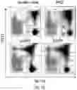 Fig. 15 - Methods of treating or preventing pyruvate kinase deficiency